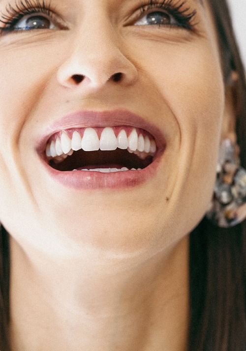 Il sorriso dei pazienti GBT